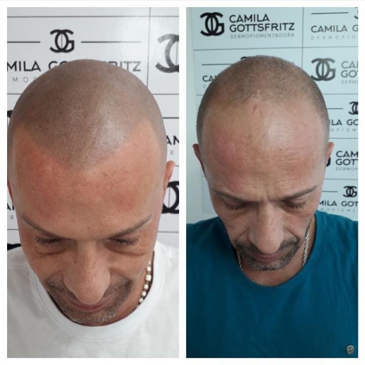 Resultado 4